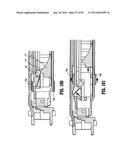 SURGICAL STAPLING APPARATUS diagram and image