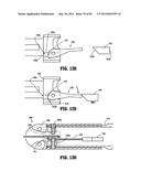 SURGICAL STAPLING APPARATUS diagram and image