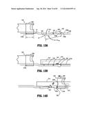 SURGICAL STAPLING APPARATUS diagram and image