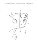 Skin Stapler with Components Optimized for Construction with Plant Based     Materials diagram and image