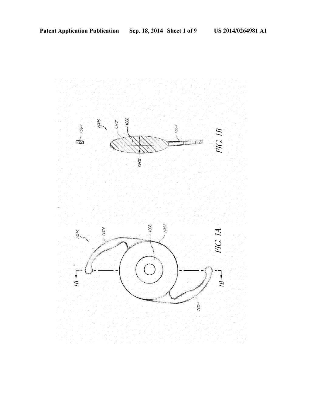 PROCESS FOR MANUFACTURING AN INTRAOCULAR LENS WITH AN EMBEDDED MASK - diagram, schematic, and image 02