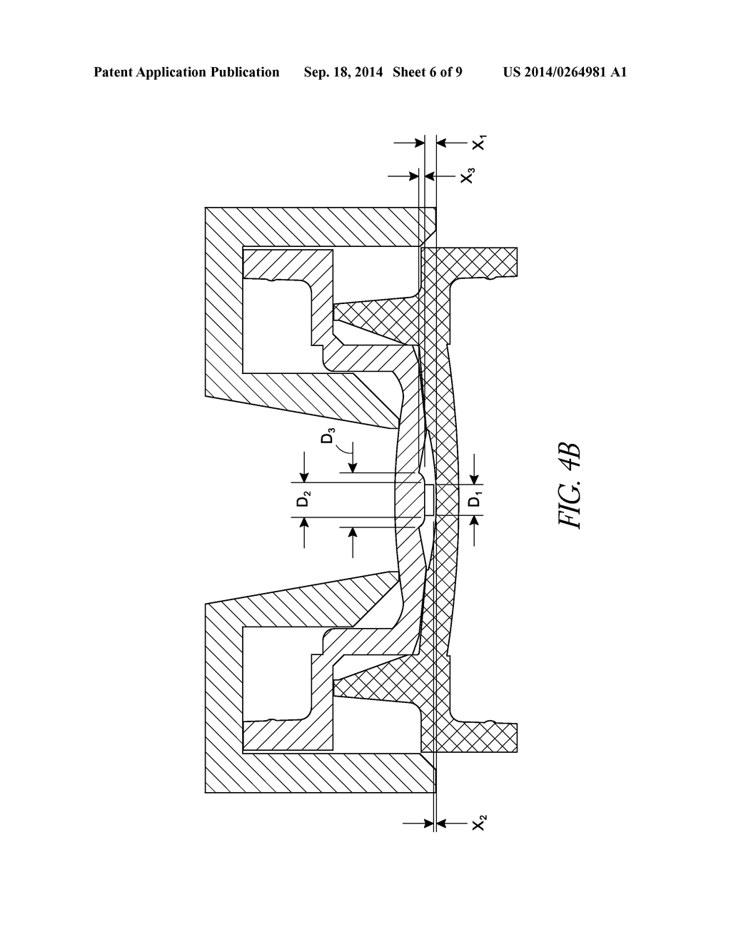 PROCESS FOR MANUFACTURING AN INTRAOCULAR LENS WITH AN EMBEDDED MASK - diagram, schematic, and image 07