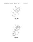 ECHOGENIC SURFACES WITH PRESSED-DIMPLE FORMATIONS diagram and image