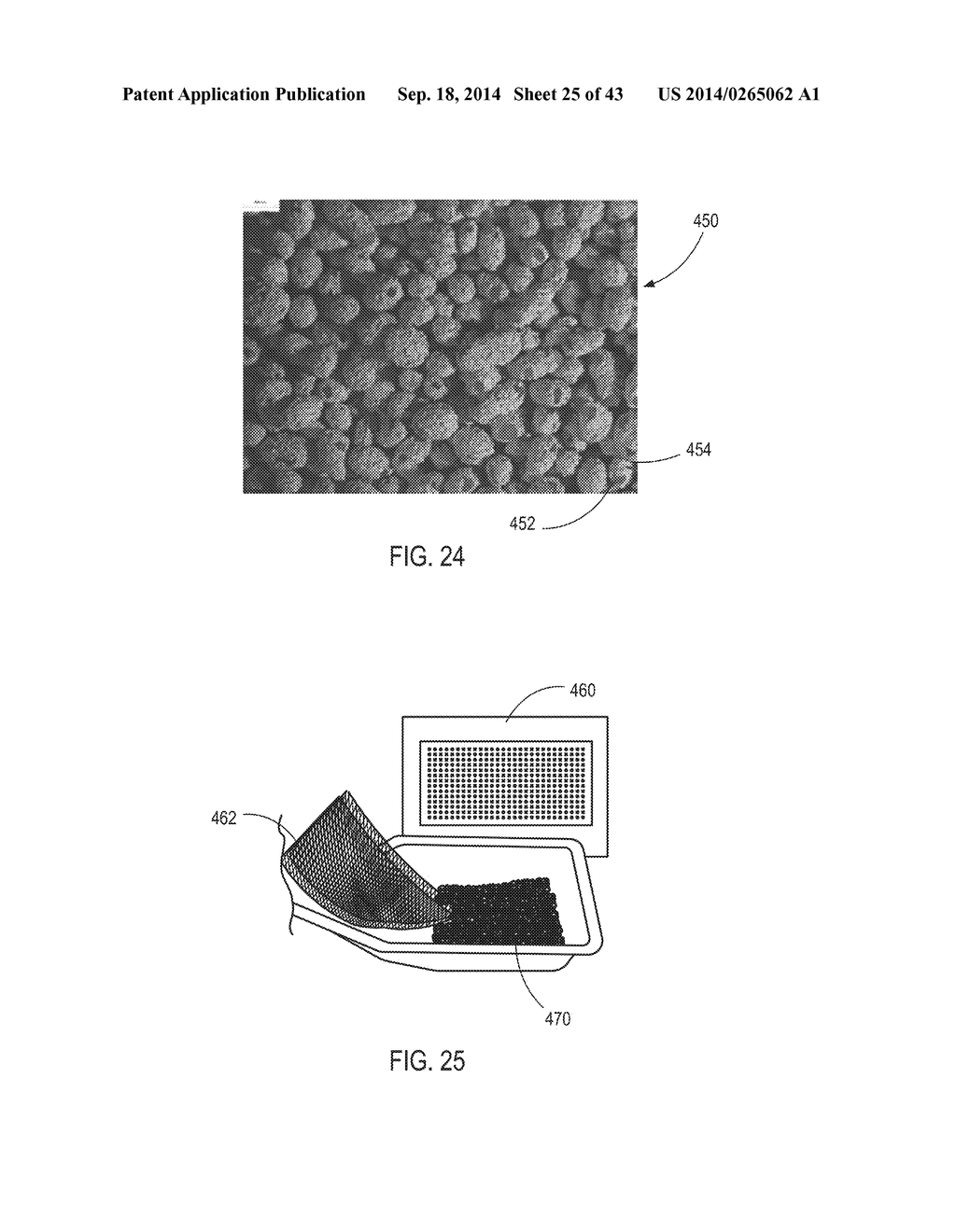 VARIABLE-DENSITY IMPLANTS AND RELATED METHODS AND SYSTEMS - diagram, schematic, and image 26