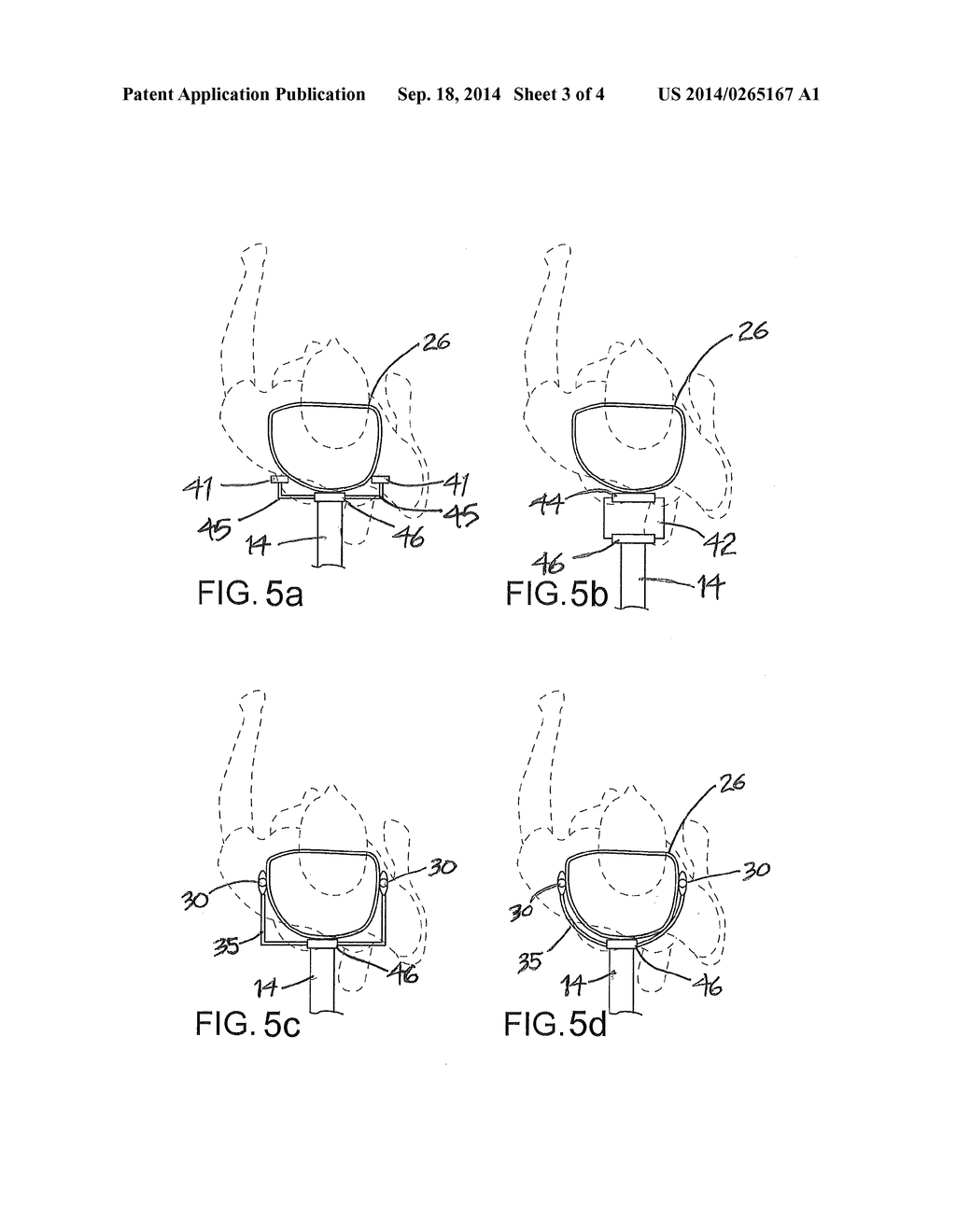 HANDS FREE CARRIAGE AND HARNESS ASSEMBLY HAVING MULTIPLE MODES OF TOWING A     LOAD - diagram, schematic, and image 04