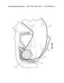 AIRBAG ASSEMBLIES WITH HEAT SHIELD DEFLECTORS diagram and image