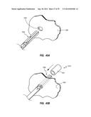 AIRBAG ASSEMBLIES WITH CONSTRAINED STABILIZER STRAPS diagram and image