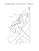 CLOSURE APPARATUS AND METHOD OF USING SAME diagram and image