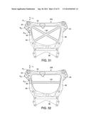 VEHICLE FRONT END STRUCTURE diagram and image