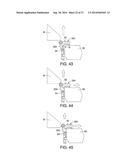 VEHICLE FRONT END STRUCTURE diagram and image