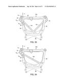 VEHICLE FRONT END STRUCTURE diagram and image