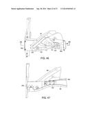 VEHICLE FRONT END STRUCTURE diagram and image