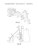 VEHICLE FRONT END STRUCTURE diagram and image