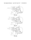 VEHICLE FRONT END STRUCTURE diagram and image