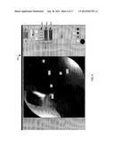 VISUALIZATION GUIDED ACL LOCALIZATION SYSTEM diagram and image