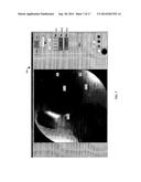 VISUALIZATION GUIDED ACL LOCALIZATION SYSTEM diagram and image