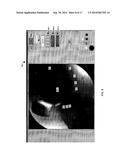 VISUALIZATION GUIDED ACL LOCALIZATION SYSTEM diagram and image