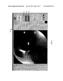 VISUALIZATION GUIDED ACL LOCALIZATION SYSTEM diagram and image