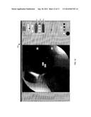 VISUALIZATION GUIDED ACL LOCALIZATION SYSTEM diagram and image