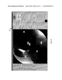 VISUALIZATION GUIDED ACL LOCALIZATION SYSTEM diagram and image