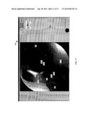 VISUALIZATION GUIDED ACL LOCALIZATION SYSTEM diagram and image