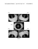 Multimodal Ocular Imager diagram and image