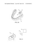 HEADSET SYSTEMS AND METHODS diagram and image