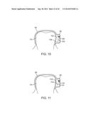 HEADSET SYSTEMS AND METHODS diagram and image