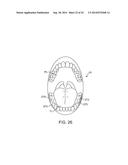 HEADSET SYSTEMS AND METHODS diagram and image