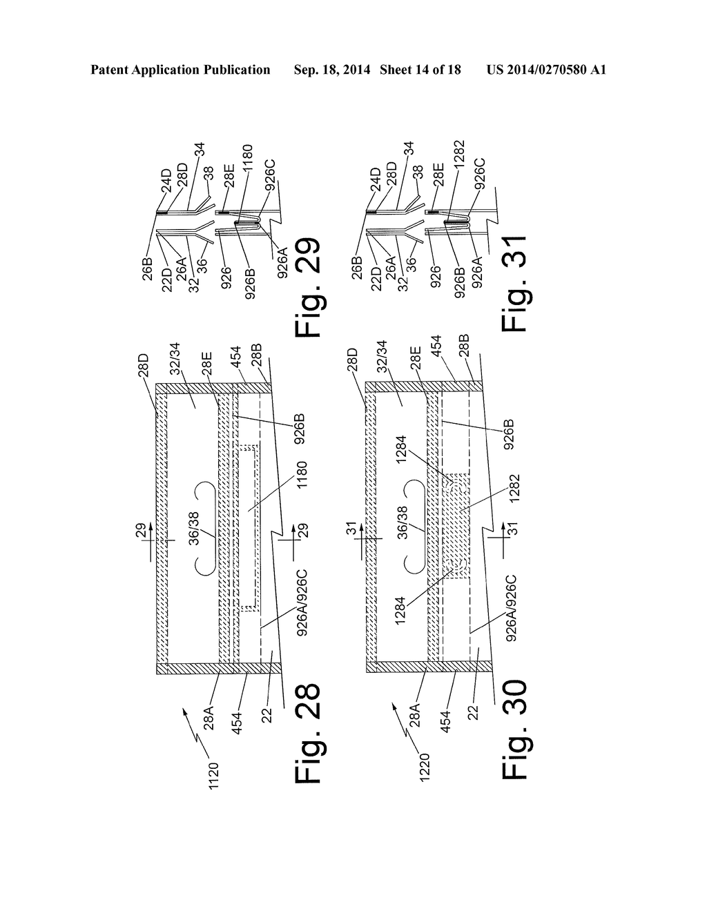 FLEXIBLE PACKAGE WITH REINFORCED TOP AND METHOD OF FILLING THE SAME - diagram, schematic, and image 15