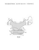 SYSTEMS AND METHODS FOR IMPROVING BOLTED JOINTS diagram and image