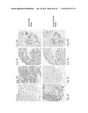 MONOCLONAL ANTIBODIES TO EGFR, AND USES THEREFOR diagram and image