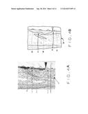 ARTICLE AND METHOD OF INITIATING BONE REGROWTH AND RESTORATION OF GUM     RECESSION WITH LOCALIZED SUBGINGIVAL DELIVERY OF MEDICATIONS diagram and image