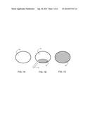 In-Situ Forming Foam for Endoscopic Lung Volume Reduction diagram and image