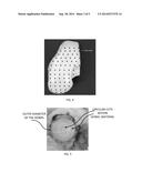 PERFORATED OSTEOCHONDRAL ALLOGRAFT COMPOSITIONS diagram and image