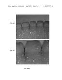 PERFORATED OSTEOCHONDRAL ALLOGRAFT COMPOSITIONS diagram and image