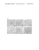 ADIPOSE TISSUE MESENCHYMAL STEM CELLS AND METHODS OF USE TO TREAT OR     INHIBIT UTERINE DISORDERS diagram and image