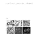 ADIPOSE TISSUE MESENCHYMAL STEM CELLS AND METHODS OF USE TO TREAT OR     INHIBIT UTERINE DISORDERS diagram and image