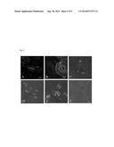 ADIPOSE TISSUE MESENCHYMAL STEM CELLS AND METHODS OF USE TO TREAT OR     INHIBIT UTERINE DISORDERS diagram and image