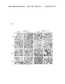 ADIPOSE TISSUE MESENCHYMAL STEM CELLS AND METHODS OF USE TO TREAT OR     INHIBIT UTERINE DISORDERS diagram and image