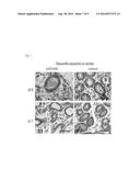 ADIPOSE TISSUE MESENCHYMAL STEM CELLS AND METHODS OF USE TO TREAT OR     INHIBIT UTERINE DISORDERS diagram and image