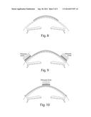 TREATMENT OF OPHTHALMIC CONDITIONS diagram and image