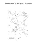 COLLAGEN AND ALGINATE-BASED FORMULATIONS FOR HEMOSTASIS diagram and image