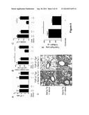 Semaphorin 7a Induced Lung Fibrogenesis Occurs in a CD-4-Dependent,     Macrophage Dependent Manner diagram and image