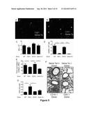 Semaphorin 7a Induced Lung Fibrogenesis Occurs in a CD-4-Dependent,     Macrophage Dependent Manner diagram and image