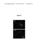 THROMBOSPONDIN-1 POLYPEPTIDES AND METHODS OF USING SAME diagram and image