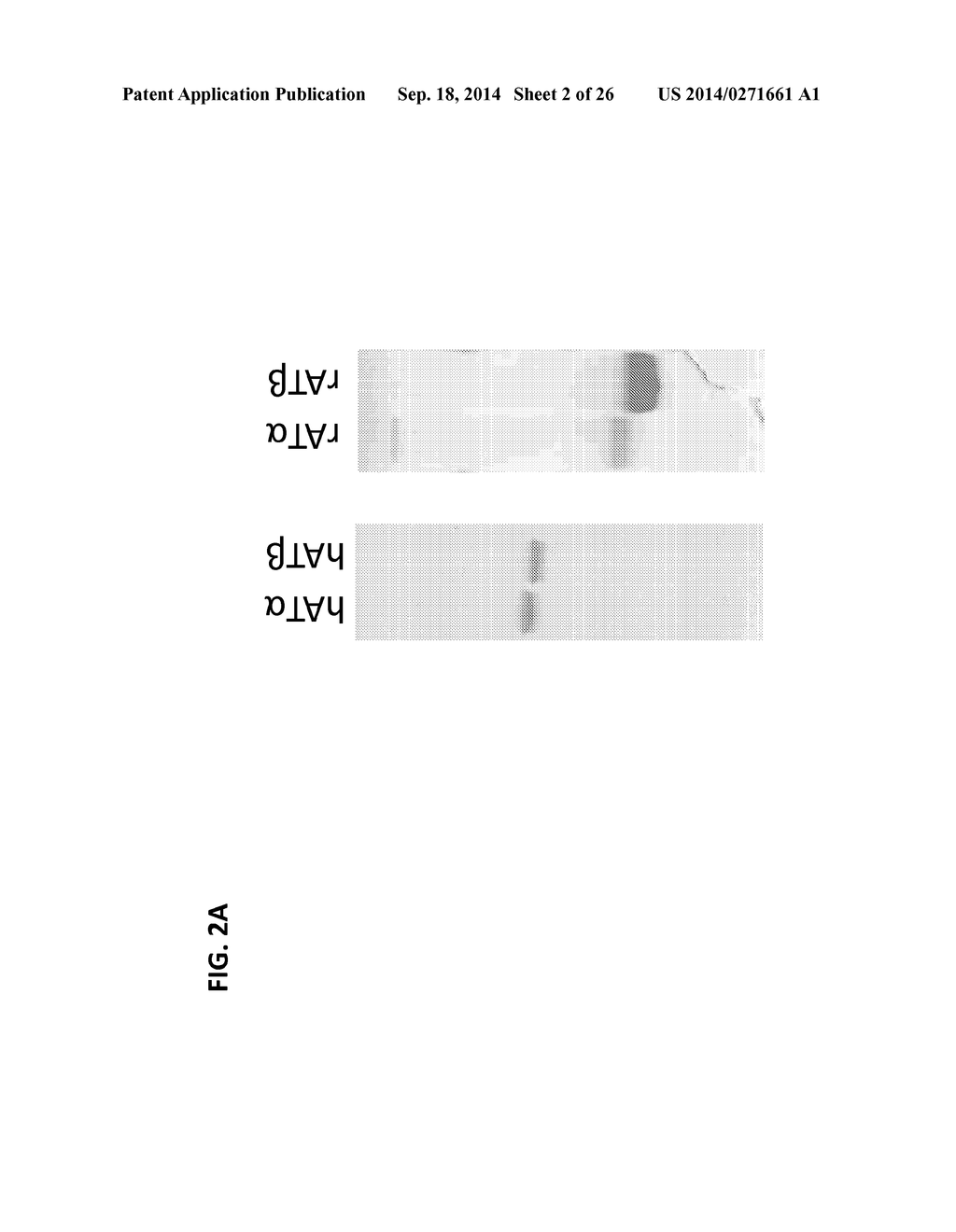 MONOCLONAL ANTIBODIES AGAINST ANTITHROMBIN BETA - diagram, schematic, and image 03