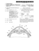 PROSTAMIDE-CONTAINING INTRAOCULAR IMPLANT diagram and image