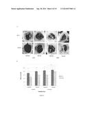 THERAPEUTIC COMPOSITIONS FOR BONE REPAIR diagram and image