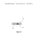 COMPOSITIONS, METHODS AND DEVICES FOR LOCAL DRUG DELIVERY diagram and image